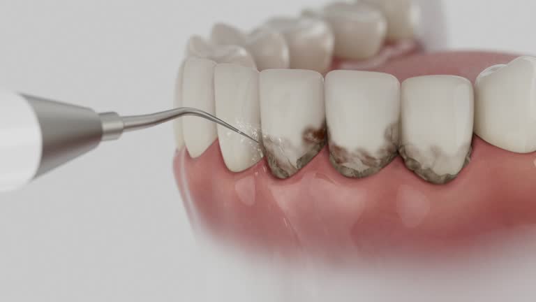 Trusted Teeth Cleaning And Checkup service in Cherokee, NC - Dentist Open Now